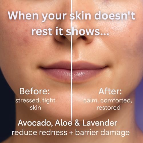 OverNight Reset™ Sleep Plus Recovery Cream